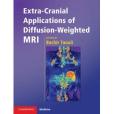 Extra-Cranial Applications of Diffusion-Weighted MRI (Cambridge Medicine (Hardcover))