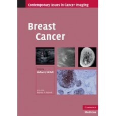 Breast Cancer (Contemporary Issues in Cancer Imaging)