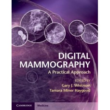 Digital Mammography: A Practical Approach (Cambridge Medicine (Hardcover))