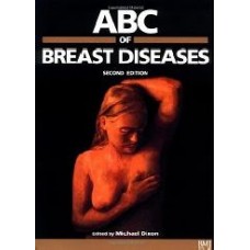 Abc Of Breast Diseases, 2E