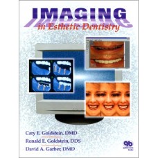 Imaging In Esthetics Dentistry