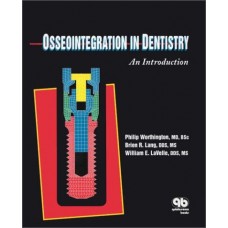 Osseointegration In Dentistry : An Introduction (Pb)