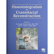 Osseointegration In Craniofacial Reconstruction (Hb)