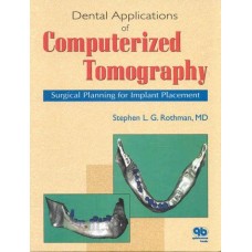 Dental Applications Of Computerized Tomography: Surgical Planning For Implant Placement