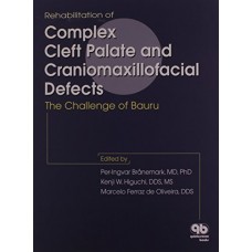 Rehabilitation Of Complex Cleft Palate And Craniomaxillofacial Defects (Hb)