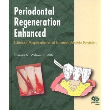 Periodontal Regeneration Enhanced : Clinical Applications Of Enamel Matrix Proteins