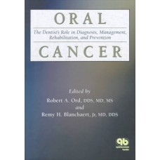 Oral Cancer: The Dentist's Role In Diagnosis, Management, Rehabilitation, And Prevention