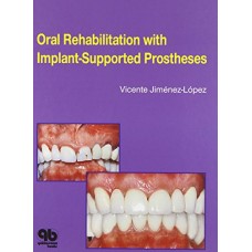 Oral Rehabilitation With Implant -Supported Prostheses (Hb)