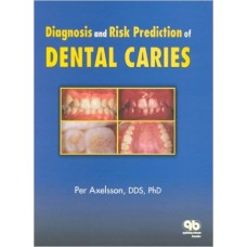 Diagnosis and Risk Prediction of Dental Caries