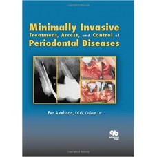Minimally Invasive Treatment, Arrest, and Control of Periodontal Diseases