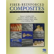 Fiber - Reinforced Compostites In Clinical Dentistry (Hb)