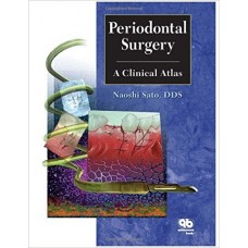 Periodontal Surgery: A Clinical Atlas 1st Edition