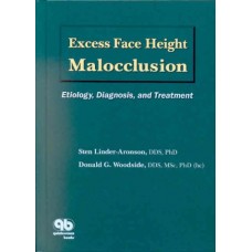 Excess Face Height Malocclusion : Etiology , Diagnosis And Treatment (Hb)
