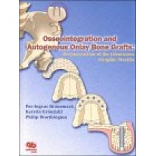 Osseointegration And Autogenous Onlay Bone Grafts (Hb)