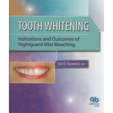 Tooth Whitening : Indications And Outcomes Of Nightguard Vital Bleaching (Hb)