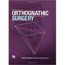Essentials of Orthognathic Surgery, 2nd Edition
