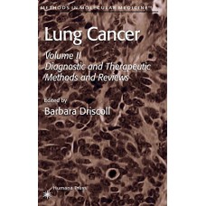 Lung Cancer: Diagnostic And Therapeutic Methods And Reviews, Volume 2