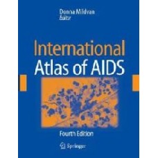 International Atlas Of Aids (Mildvan International Atlas Of Aids)  (Hardcover)