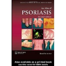 An Atlas Of Psoriasis Second Edition (Encyclopedia Of Visual Medicine Series)  (Hardcover)