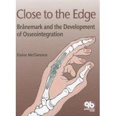 Close To The Edge: Branemark And The Development Of Osseointegration