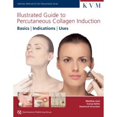 Illustrated Guide To Percutaneous Collagen Induction Basic ,Indications Uses