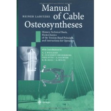 Manual Of Cable Osteosyntheses