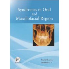 Syndromes in Oral and Maxillofacial Region [Paperback]