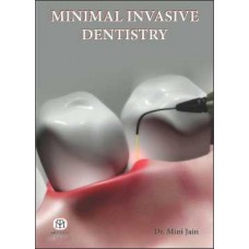 Minimal Invasive Dentistry [Paperback]