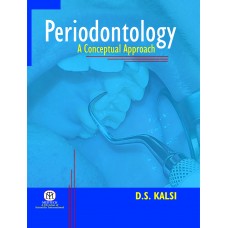 Periodontology: A conceptual Approach