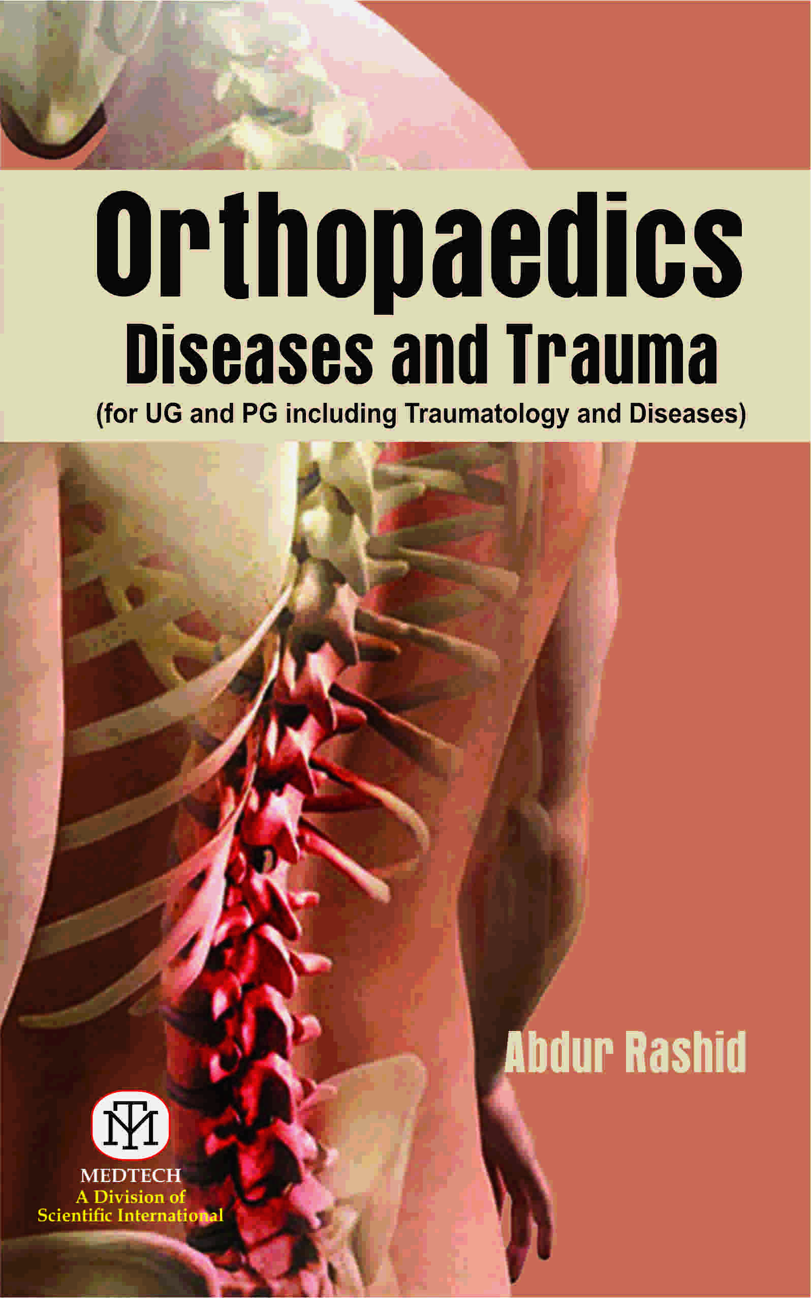 ORTHOPAEDICS DISEASES AND TRAUMA (FOR UG AND PG INCLUDING TRAUMATOLOGY AND DISEASES)