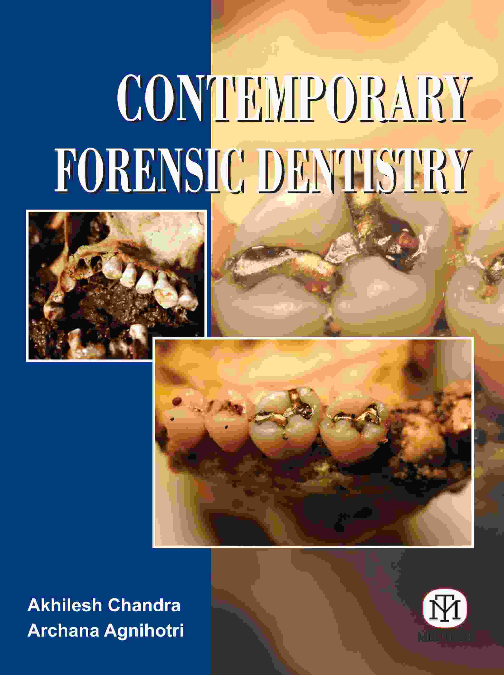 CONTEMPORARY FORENSIC DENTISTRY