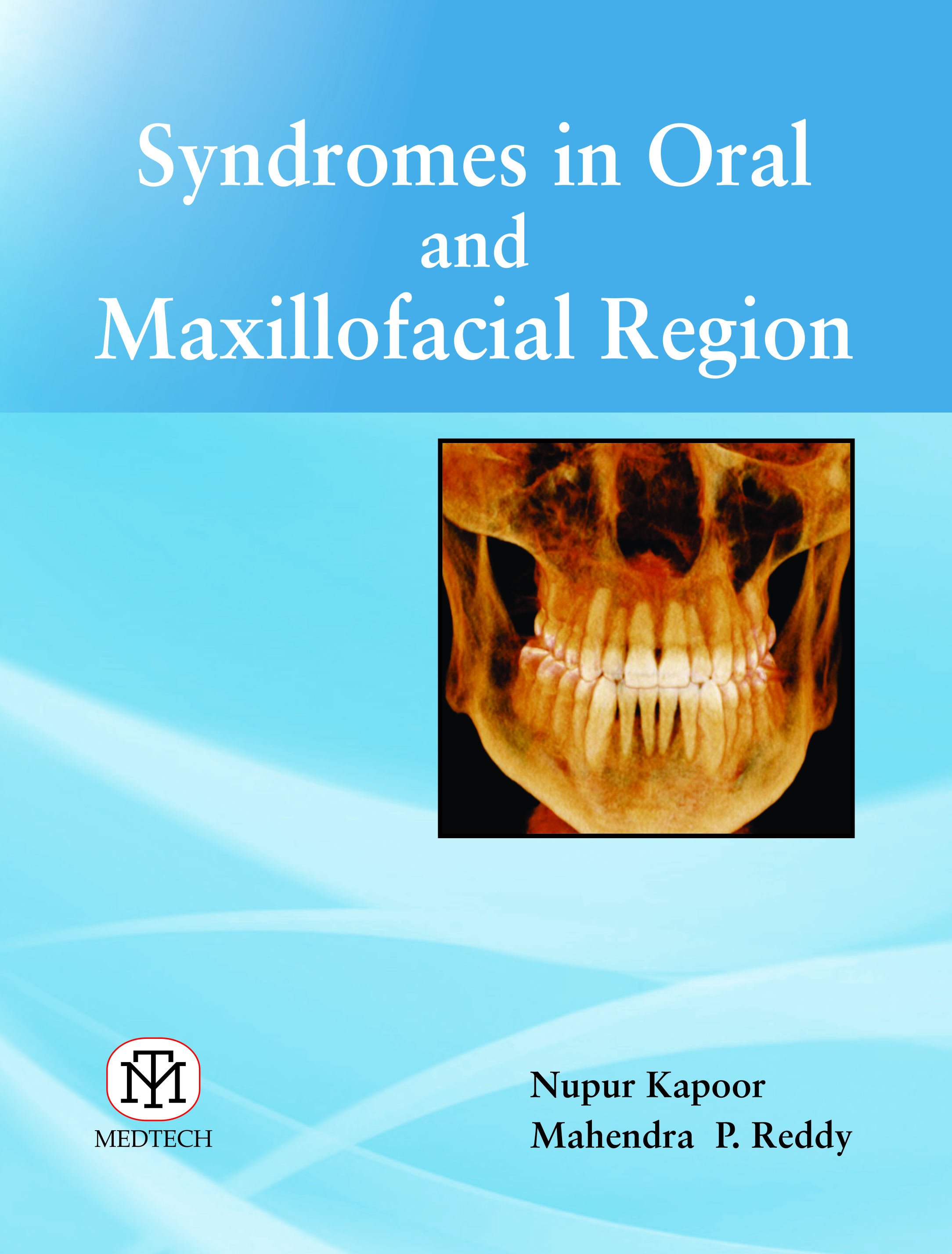 Syndromes In Oral And Maxillofacial Region (Pb)