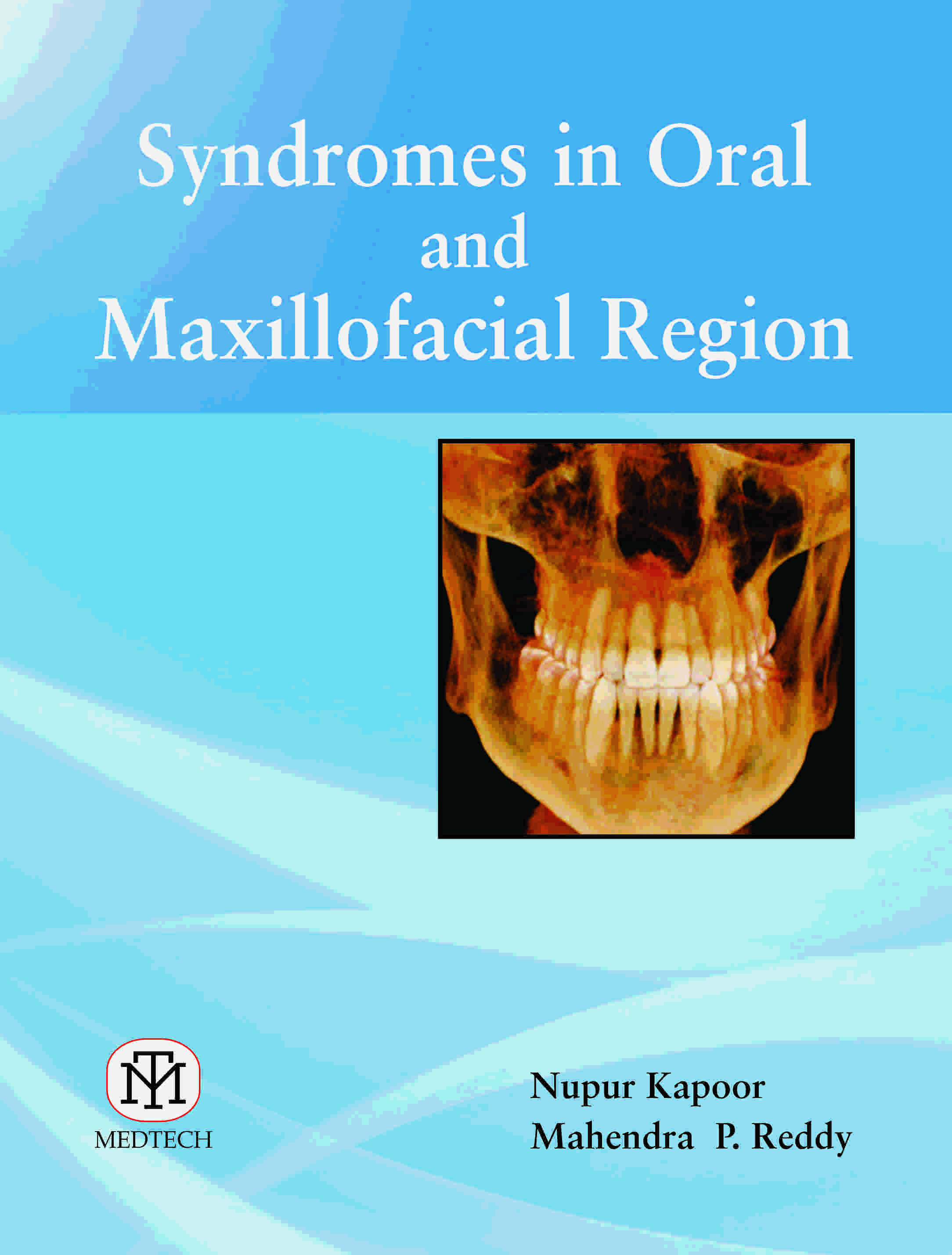 SYNDROMES IN ORAL AND MAXILLOFACIAL REGION