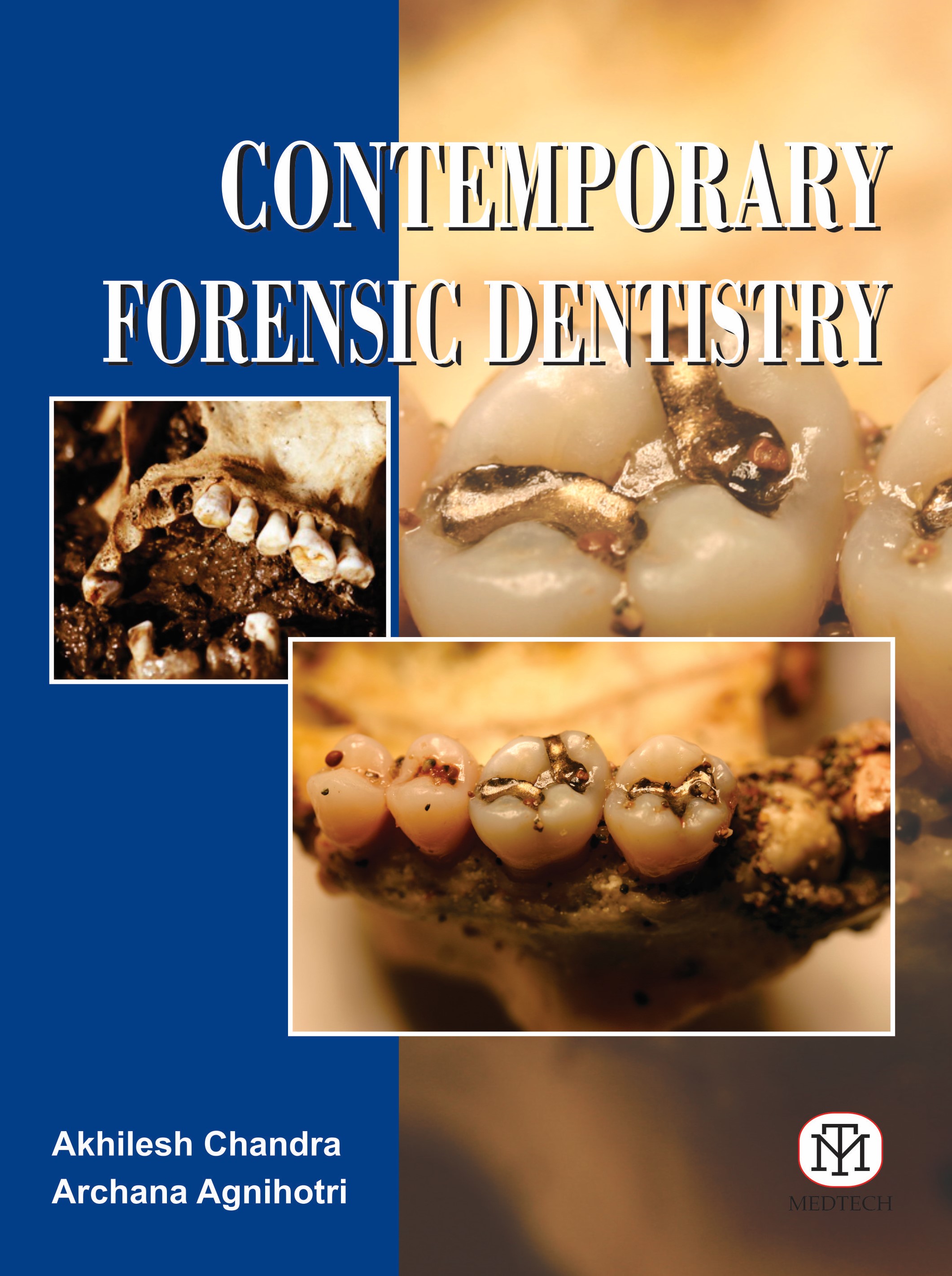 CONTEMPORARY FORENSIC DENTISTRY
