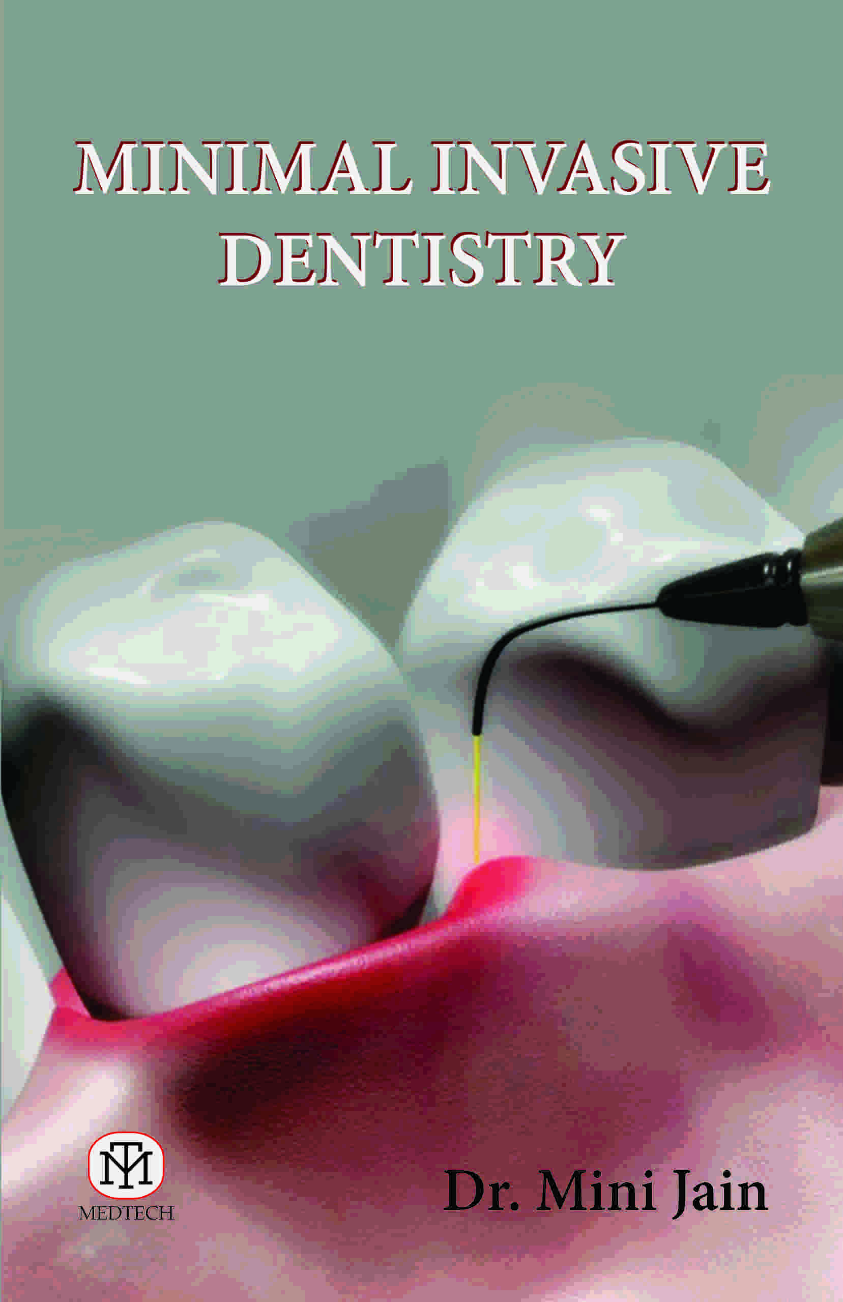 MINIMAL INVASIVE DENTISTRY
