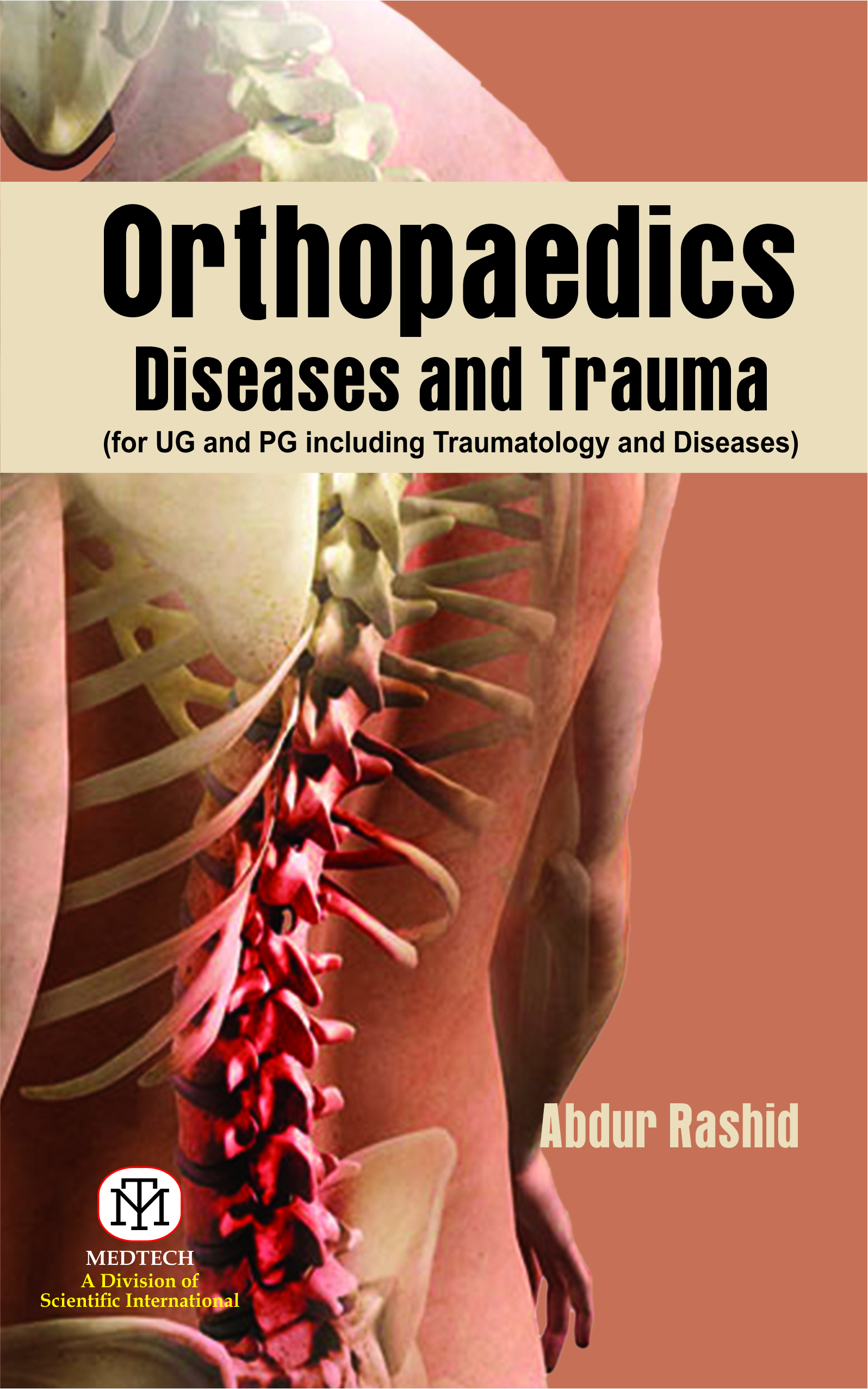 Orthopaedics Diseases And Trauma (For Ug And Pg Including Traumatology And Diseases)-Pb